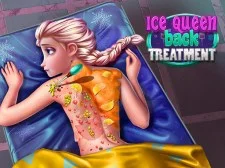 Tratamentul Reginei Ice Back